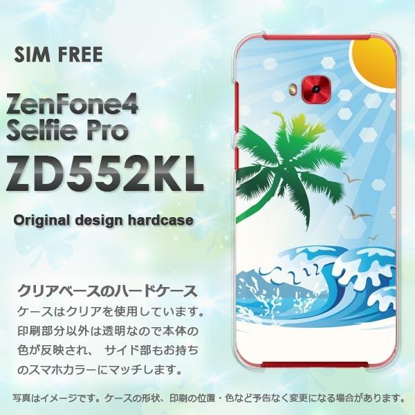 Zen Fone4 Selfie Pro ZD552KL  āEVvECEV̖(u[)/zd552kl-pc-new0767