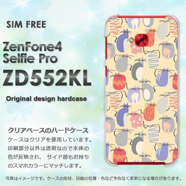  Zen Fone4 Selfie Pro ZD552KL  EL(x[W)/zd552kl-pc-new0973