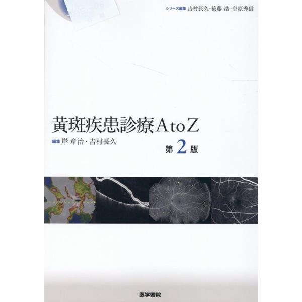 黄斑疾患診療AtoZ 第2版 岸章治 黄斑疾患診療AtoZ 第2版 眼科臨床エキスパート Book