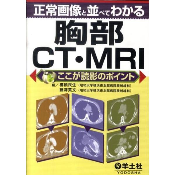 正常画像と並べてわかる胸部CT・MRI/櫛橋民生/藤澤英文