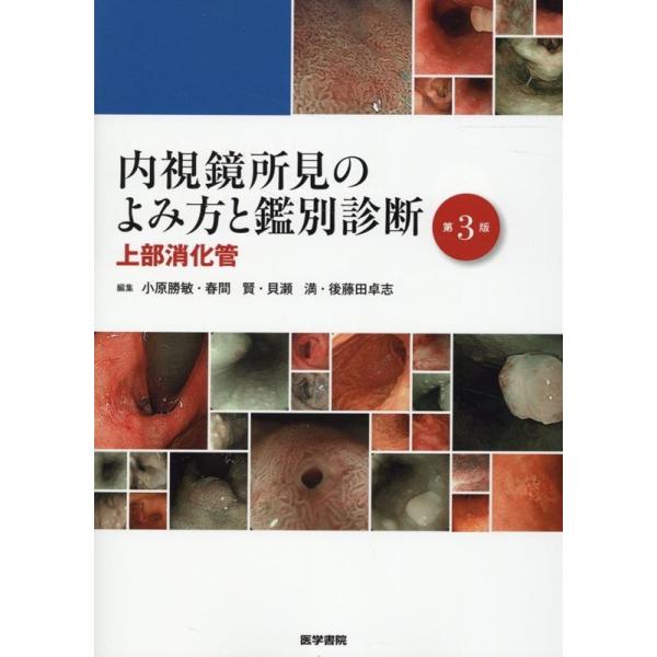 内視鏡所見のよみ方と鑑別診断 上部消化管 第3版 小原勝敏 内視鏡所見のよみ方と鑑別診断-上部消化管 第3版 Book