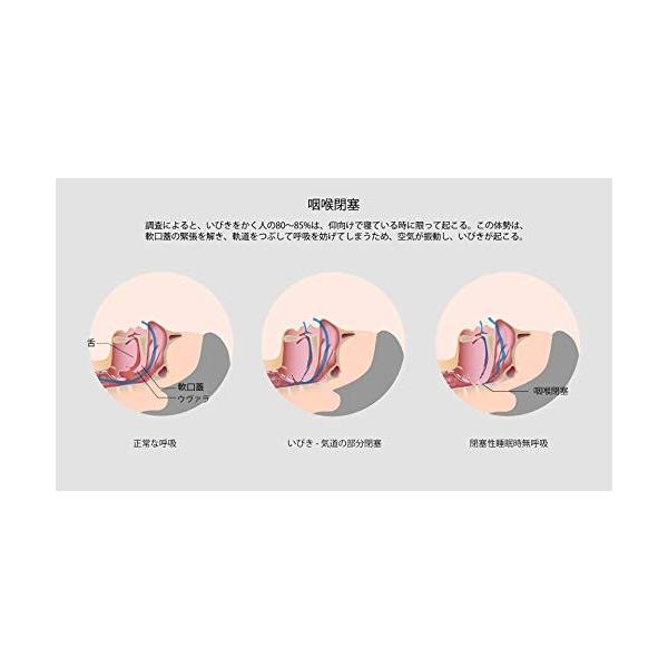Woodyknows 横向きの姿勢の寝るバックパック いびき防止グッズ イビキ軽減 解消 いびき対策枕 快眠グッズ 鼻呼吸 Sas無呼吸症候群 まくら Www Supersport Tn