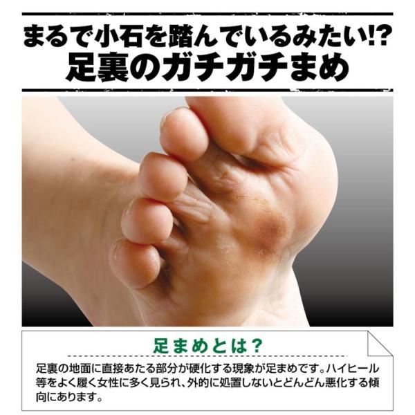 足マメパック マーメナイン 足まめ 痛い 足裏 足の裏 角質除去 足の角質 フットケア 足 角質 除去 パック 角質ケア 削らない Buyee Buyee 日本の通販商品 オークションの入札サポート 購入サポートサービス
