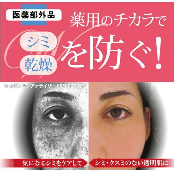 しみ取り オールインワンジェル 薬用シミバスター プレミアム シミ取りクリーム シミ そばかす 消す 美白 化粧品 オールインワン Buyee Buyee Japanese Proxy Service Buy From Japan Bot Online