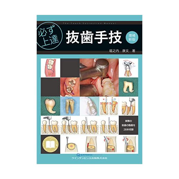必ず上達抜歯手技 81zw-qlf8bL.jpg