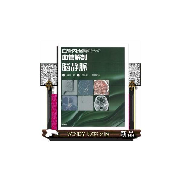 血管内治療のための血管解剖脳静脈