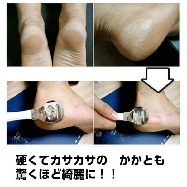 かかと 角質取り 5点セット 角質除去 つるつる 魚の目 角質削り 替刃 送料無料 Buyee Buyee Japanese Proxy Service Buy From Japan Bot Online