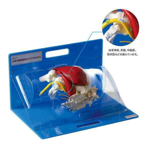 坐骨神経刺鍼部位クリア3dモデル 鍼灸模型 鍼刺入可 Am 3 0 代引不可 Ds ワインプラザマツムラ Yahoo 店 通販 Yahoo ショッピング