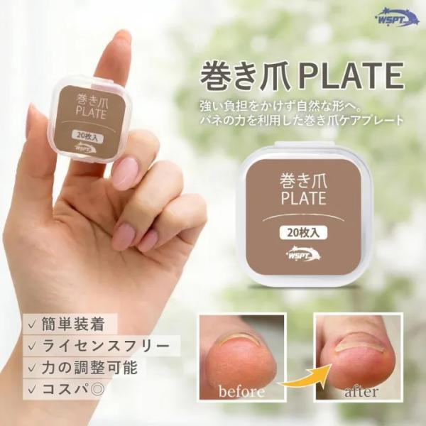 【巻き爪ケア】巻き爪プレート 巻き爪PLATE