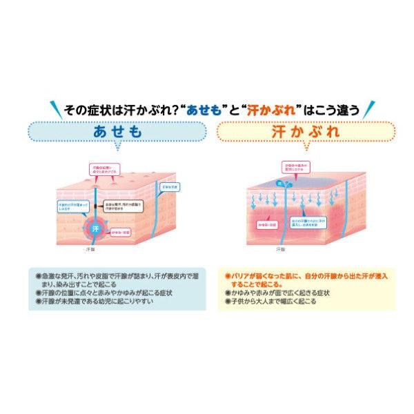アセムヒex 15g 池田模範堂 控除 汗かぶれ あせも かゆみ 指定第2類医薬品 Buyee Buyee Japanese Proxy Service Buy From Japan Bot Online