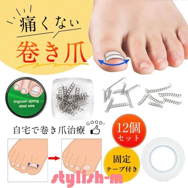 巻き爪 矯正 巻き爪チェーン 治療 爪ワイヤー テープ付き 12個 自宅で