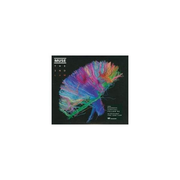 輸入品】MUSE／2nd Law: Super Deluxe Box Set The 2nd Law