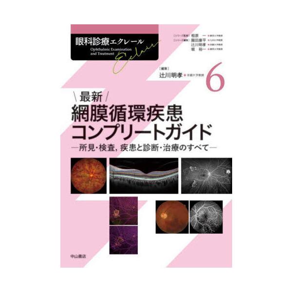 最新網膜循環疾患コンプリートガイド : 有隣堂ヤフーショッピング店