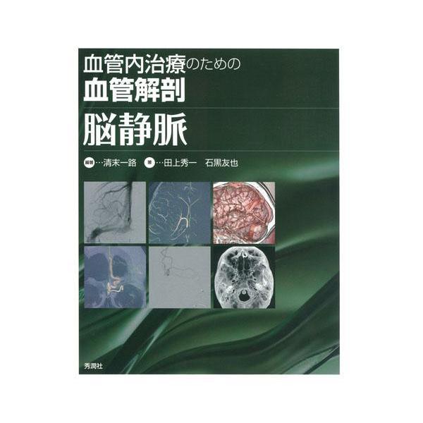 血管内治療のための血管解剖脳静脈