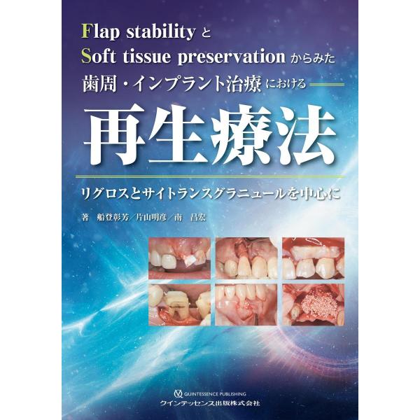 イラストレイテッド 歯周外科アドバンステクニック | 白石 和仁 イラストレイテッド 歯周外科アドバンステクニック | 白石 和仁