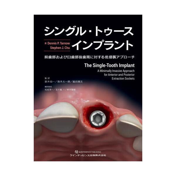 シングル・トゥース インプラント シングル・トゥースインプラント : 有隣堂ヤフーショッピング店 - 通販