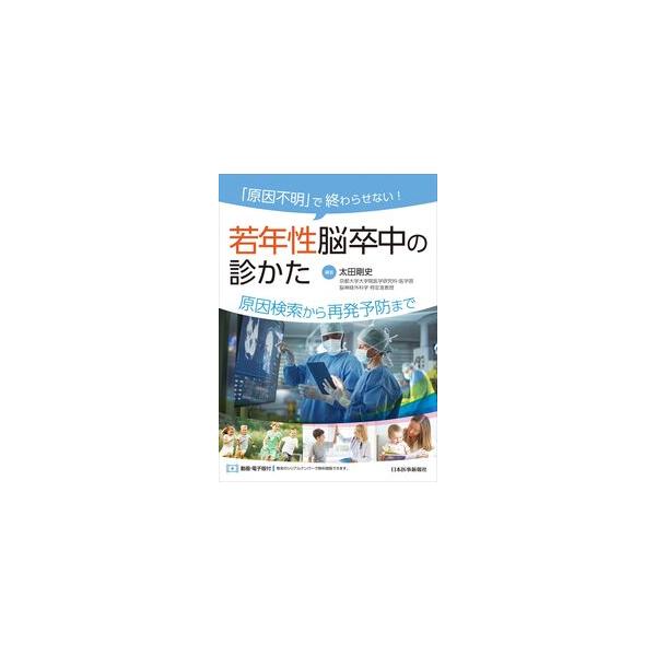 「原因不明」で終わらせない! 若年性脳卒中の診かた