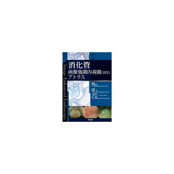 消化管画像強調内視鏡(IEE)アトラス : 有隣堂ヤフーショッピング店