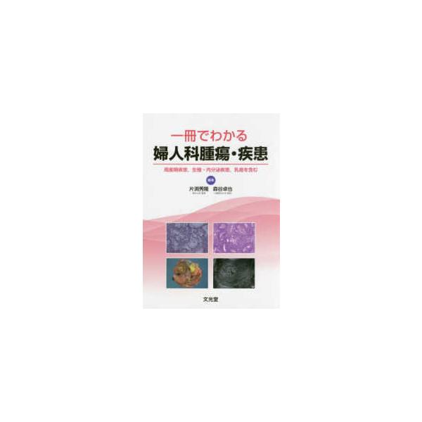 一冊でわかる婦人科腫瘍・疾患 一冊でわかる婦人科腫瘍・疾患-周産期疾患、生殖・内分泌疾患、乳癌を