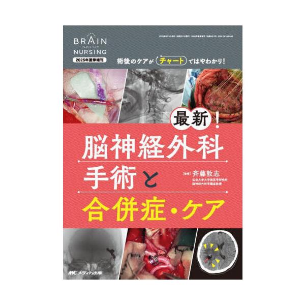 最新脳神経外科手術 　金芳堂 最新!脳神経外科手術と合併症・ケア : 有隣堂ヤフーショッピング店