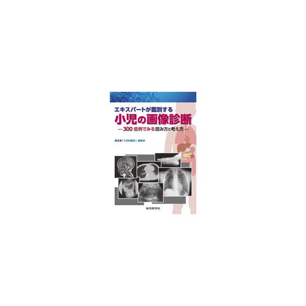 裁断済　エキスパートが鑑別する小児の画像診断 : 300症例でみる読み方と考え方 エキスパートが鑑別する小児の画像診断 300症例でみる読み方と