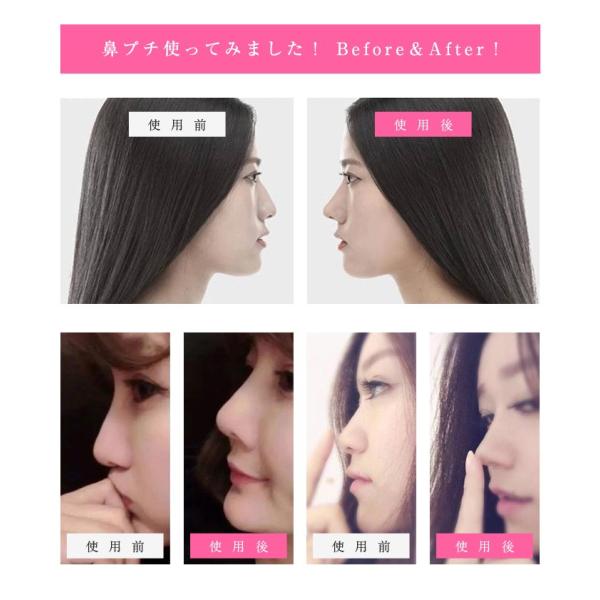 鼻プチ 効果 プチ整形 鼻メイク 鼻UP 鼻のアイプチ 鼻を高くする方法 マジックノーズ 3サイズセット 美鼻スジ効果 アイテム 痛くない 激安 雑貨 /【Buyee】 鼻プチ 効果 プチ整形 鼻メイク 鼻UP 鼻のアイプチ 鼻を高くする方法 マジックノーズ 3サイズセット 美鼻スジ効果 アイテム 痛くない 激安 雑貨 /【Buyee】