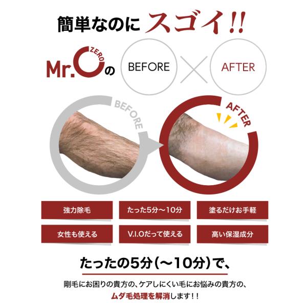 除毛クリーム メンズ 送料無料 リムーバークリーム アンダーヘア スキンケア Mr Zero 1本 Vio 自宅 セルフ 脱毛 男性 女性 背中 産毛 ムダ毛 処理 医薬部外品 Buyee Buyee Japanese Proxy Service Buy From Japan Bot Online
