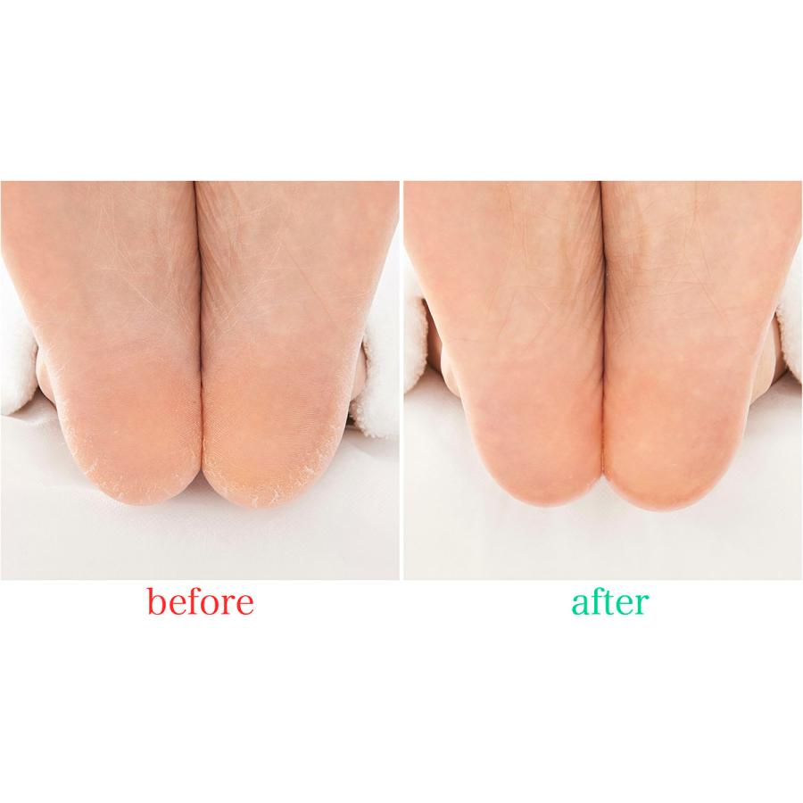 SpaLuce スパルーチェ]大人気 フットケアローション プラス90mL+