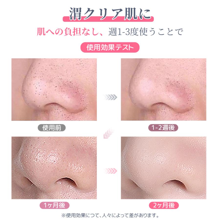 ラッピング対応 毛穴吸引器 美顔器 保湿 毛穴ケア 水流式 3段階 毛穴吸引 毛穴 吸引 いちご鼻 黒ずみ 角栓 除去 顔 エステ 皮脂 スキンケア 鼻 美肌 引き締め Mr Sd08 1kselect 通販 Yahoo ショッピング