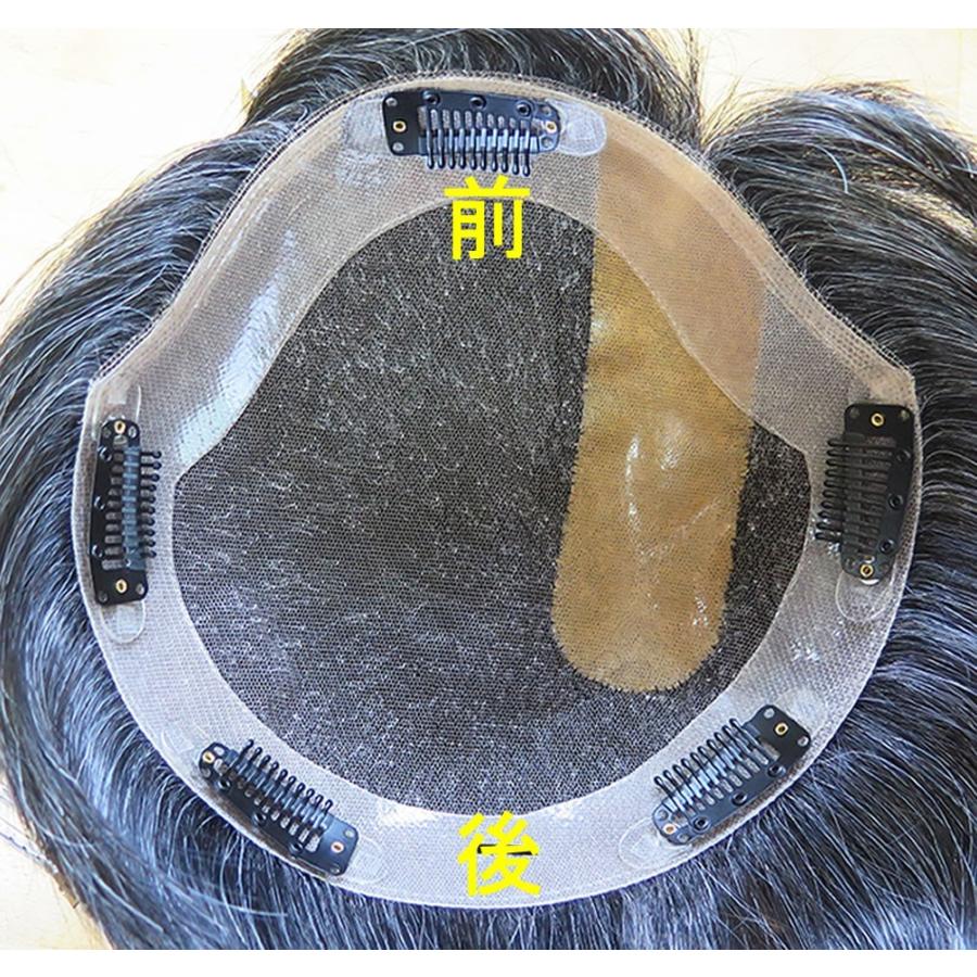 クリップ取り付け料 | 