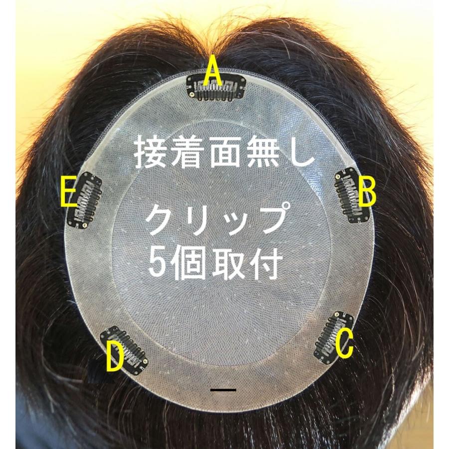 クリップ取り付け料 |  | 03