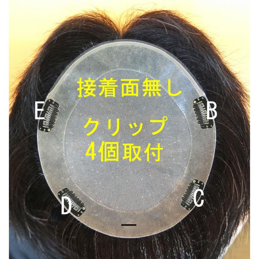 クリップ取り付け料 |  | 04