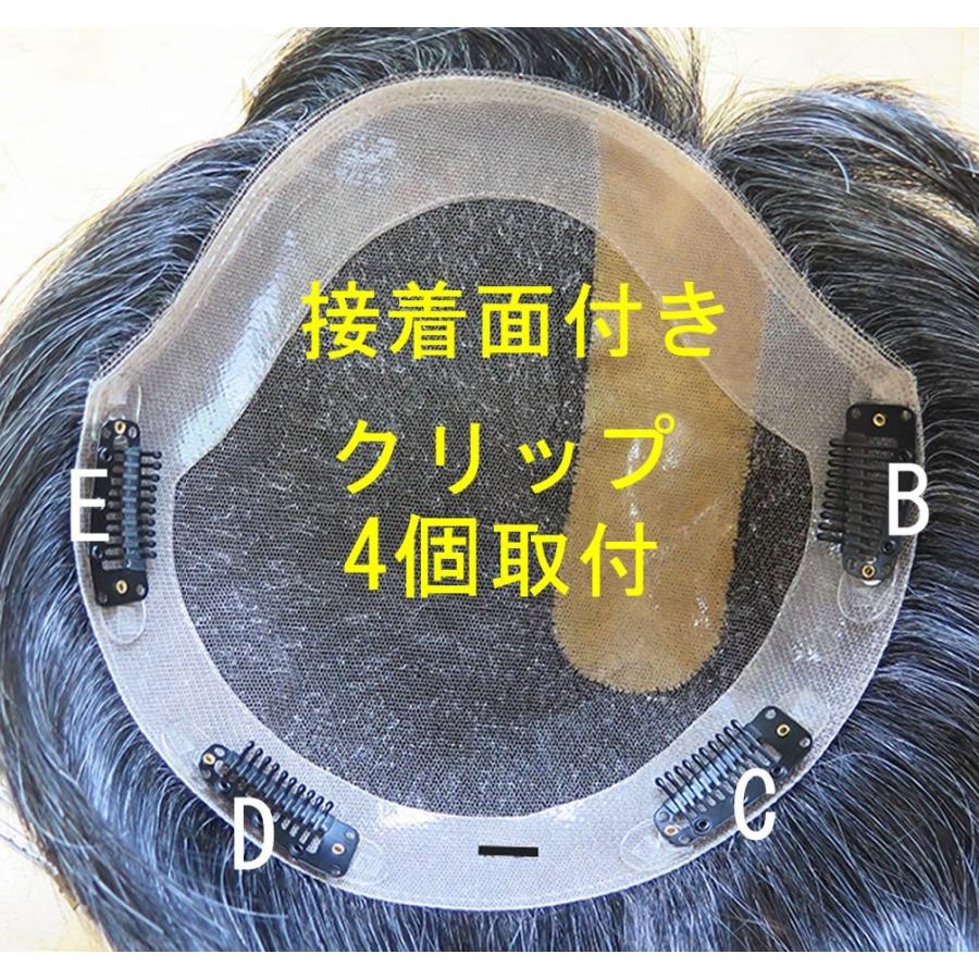 クリップ取り付け料 |  | 06