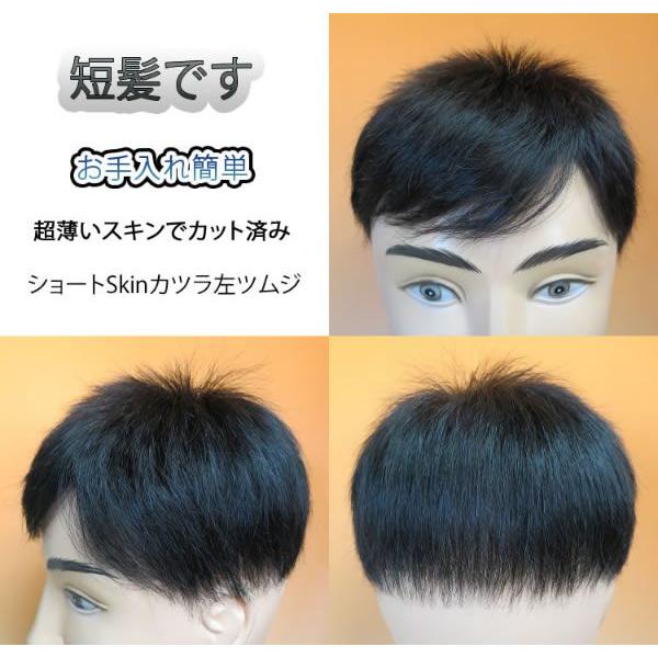 ショートSkinカツラ左ツムジ　部分かつら | 