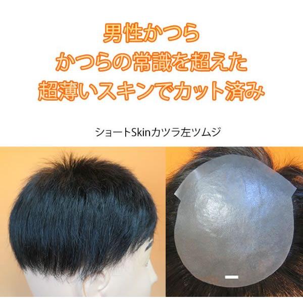 ショートSkinカツラ左ツムジ　部分かつら |  | 02