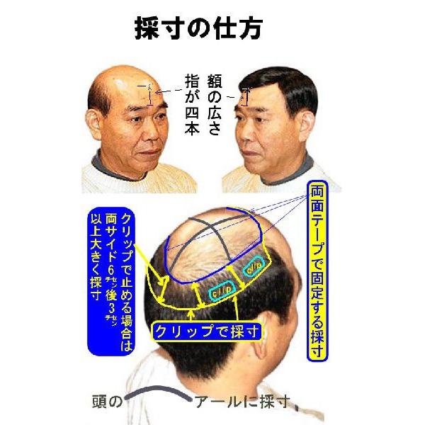 LLサイズセンターパート、カット済み人工皮膚付き　部分かつら、毛量：やや多め |  | 03