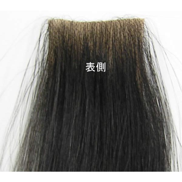 円形脱毛シルクシート(皮膚貼付用両面テープ約30枚付) |  | 01