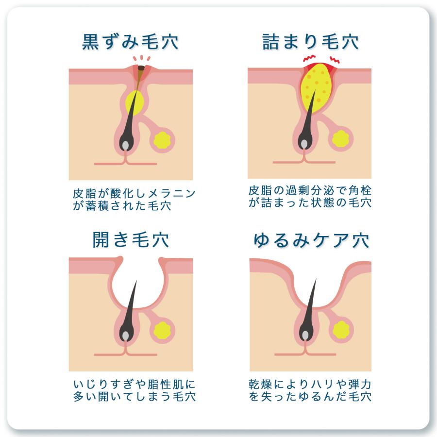 ポアレスエッセンス 100ml 美容液 保湿 ハリ キメ 角質ケア ビタミンC誘導体 EGF 白金ナノコロイド プラセンタ コラーゲン Skin Care Ism スキンケアイズム｜315select｜03