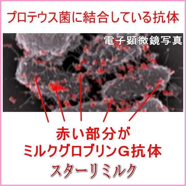 免疫ミルク 兼松 スターリミルク 2箱 免疫力 高める サプリメント 免疫ミルク 免疫グロブリン スキムミルク 免疫力 兼松ウエルネス 免疫 母乳 Stollemilk 02 マルタケヤフー店 通販 Yahoo ショッピング