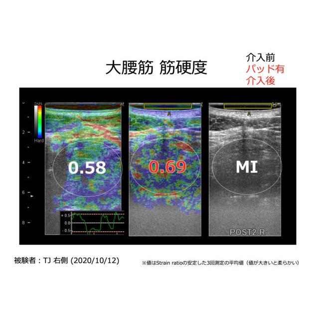 太腿に巻くだけ、腰が上機嫌 大腰筋の緊張緩和ベルト「ヨーツナー」 送料無料 ポイント10倍 ギフト プレゼント 誕生日 敬老の日 太もも 大腰筋 腰 | ユタカメイク | 05