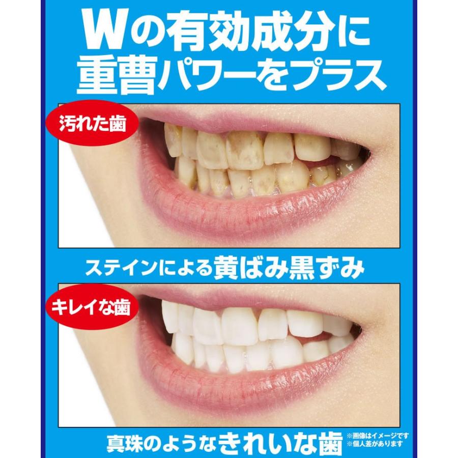 薬用重曹ステインプロ ホワイトニングレーザー 2個セット 送料無料 ホワイトニング オーラルケア 白い歯 ヤニ汚れ Mr 2670 2 Mr 2670 2 セブンパレット 通販 Yahoo ショッピング
