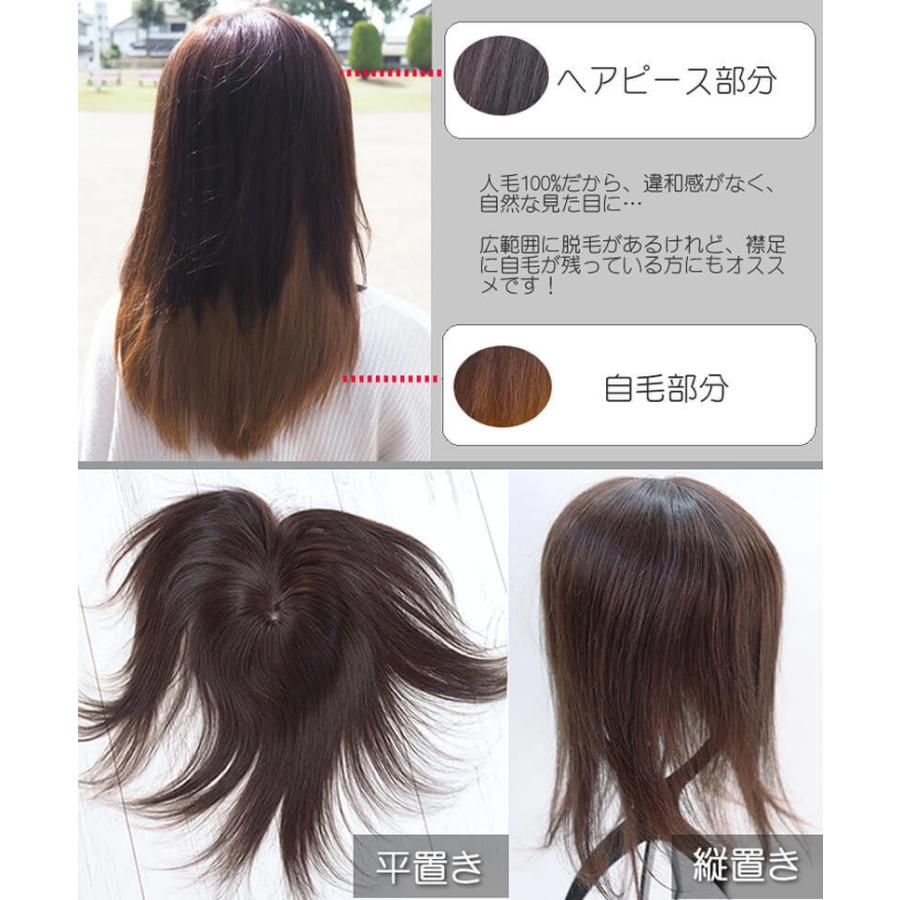 ヘアピース【ふんわり髪リアルスキン・L】人毛100％ つむじ付き 部分ウィッグ 医療用ウィッグ_10