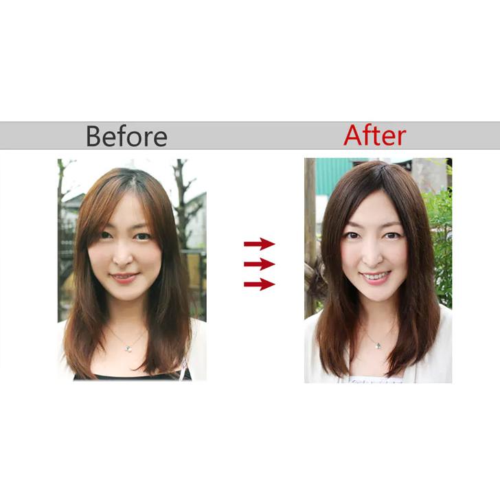 ヘアピース【ふんわり髪リアルスキン・S】人毛100％ つむじ付き 部分ウィッグ 医療用ウィッグ_5