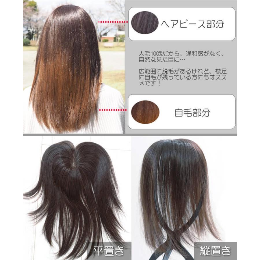 ヘアピース【ふんわり髪リアルスキン・S】人毛100％ つむじ付き 部分ウィッグ 医療用ウィッグ_10