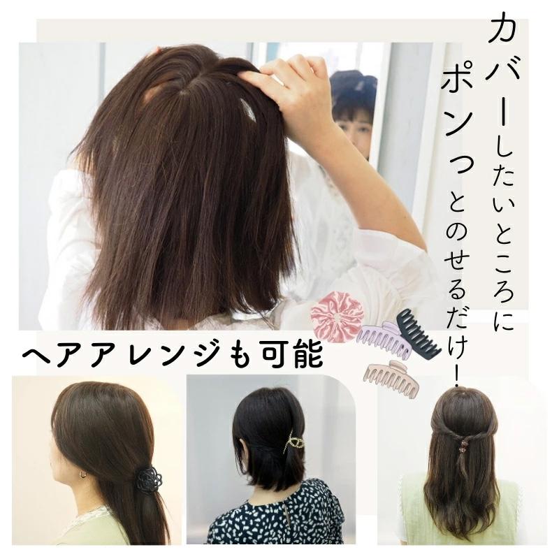 ヘアピース【通気性リアルスキン・S】人毛100％ つむじ付き 部分ウィッグ 医療用ウィッグ_7