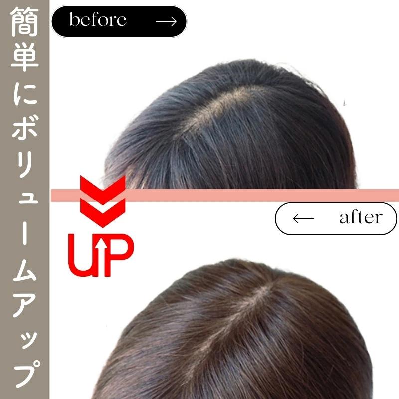 ヘアピース【通気性リアルスキン・S】人毛100％ つむじ付き 部分ウィッグ 医療用ウィッグ_9
