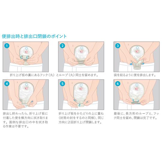 センシュラ ミオ1 消化管ストーマ用 単品系装具 透明 30mm 1箱 10枚入