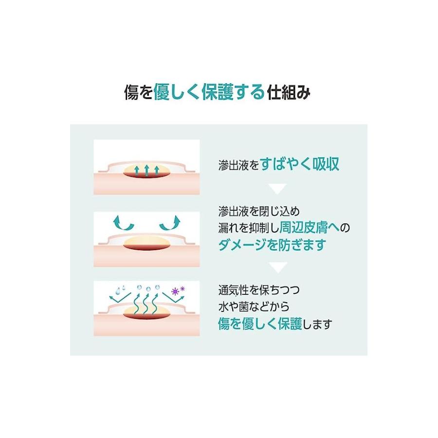 オプティフォーム ジェントルEX 仙骨 5枚×8箱入 ニトムズ 医療機器認証取得済 (65-8736-09)_5