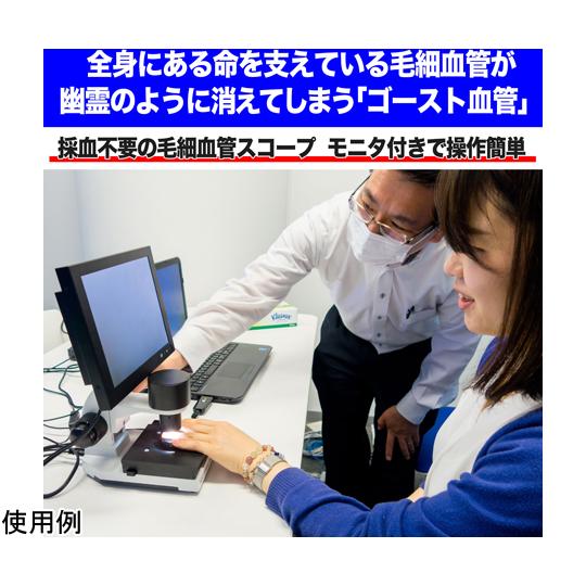 血流スコープ 240倍 佐藤商事 MJ-BL10 (67-5519-48)の画像