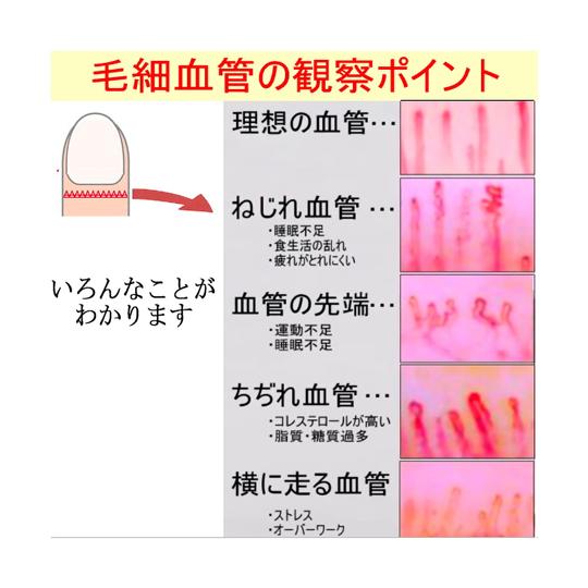 血流スコープ 240倍 佐藤商事 MJ-BL10 (67-5519-48)の画像